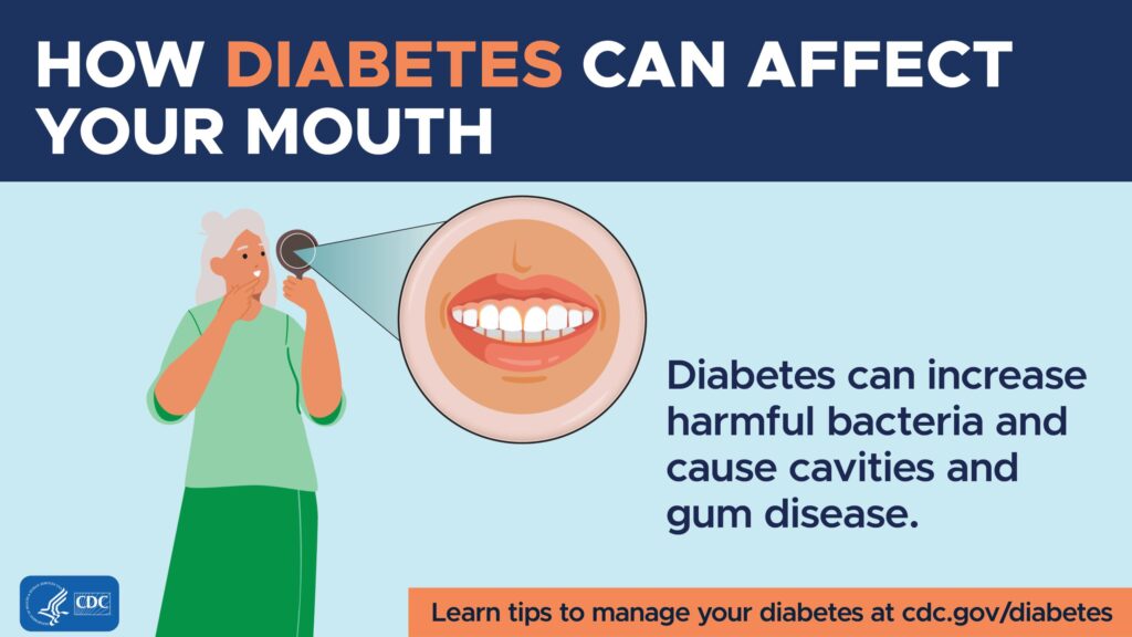 Diabetes Affect Mouth