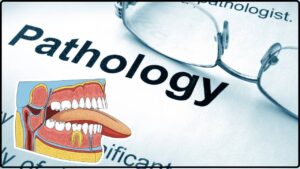 Salivary Gland Pathology