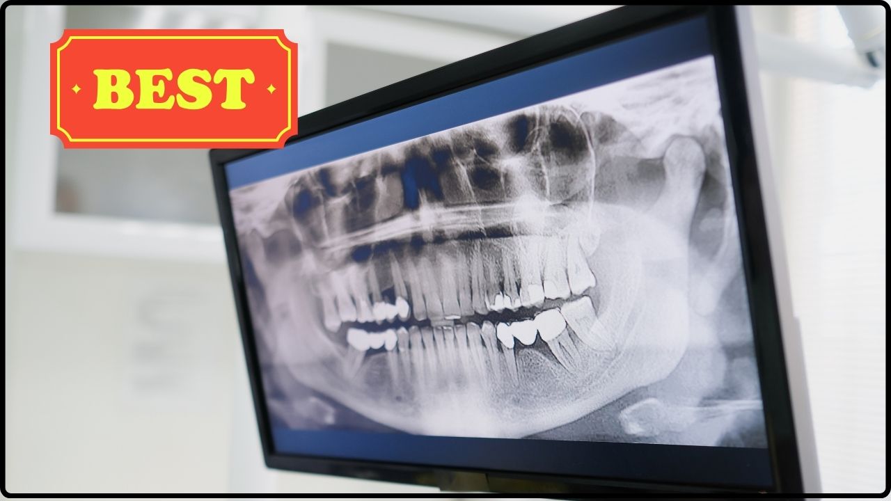 Best Portable Dental X-Ray Machines for Private Practice: Features and Safety.